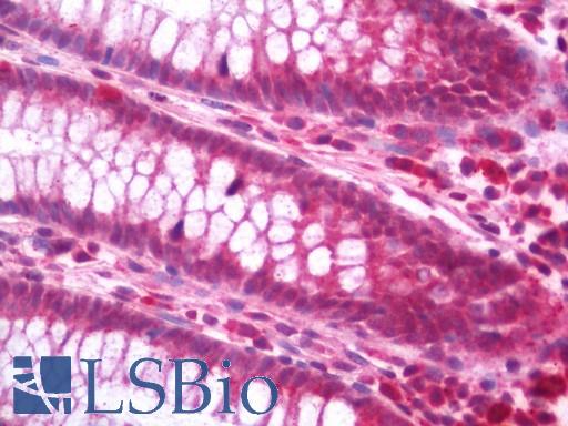 Anti-DMP1 antibody IHC staining of human colon. Immunohistochemistry of formalin-fixed, paraffin-embedded tissue after heat-induced antigen retrieval. Antibody LS-B11226 concentration 5 ug/ml.