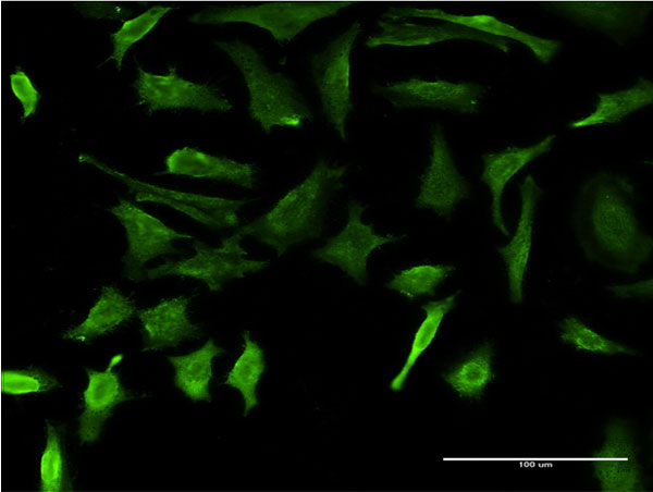 Immunofluorescence of monoclonal antibody to DMP1 on HeLa cell . [antibody concentration 10 ug/ml]