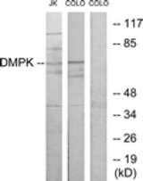 Western blot of extracts from Jurkat/COLO205 cells, using DMPK Antibody. The lane on the right is treated with the synthesized peptide.