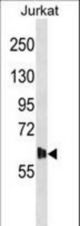 DMPK Antibody western blot of Jurkat cell line lysates (35 ug/lane). The DMPK antibody detected the DMPK protein (arrow).