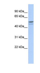 DMRTA1 antibody LS-C109761 Western blot of HeLa lysate.