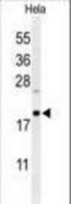 Western blot of CLEC2B Antibody in HeLa cell line lysates (35 ug/lane). CLEC2B (arrow) was detected using the purified antibody.