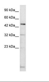 Jurkat Cell Lysate