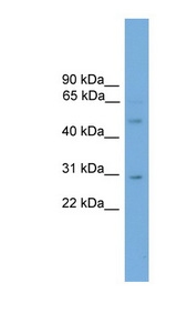 DMRT3 antibody LS-C116124 Western blot of Mouse Kidney lysate.