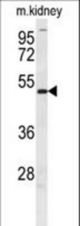 DMRT3 Antibody western blot of mouse kidney tissue lysates (35 ug/lane). The DMRT3 antibody detected the DMRT3 protein (arrow).