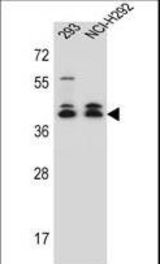 DMRTC2 Antibody western blot of 293,NCI-H292 cell line lysates (35 ug/lane). The DMRTC2 antibody detected the DMRTC2 protein (arrow).
