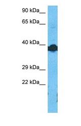 Western blot of DMRTD Antibody with human Fetal Lung lysate.