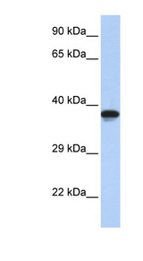 DMRTC2 antibody LS-C101598 Western blot of Jurkat lysate.