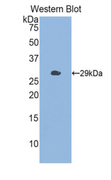 Western blot of recombinant CHI3L1 / YKL-40.