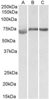 DMTF1 antibody (1 ug/ml) staining of Human (A), Mouse (B) and Rat (C) Testis lysate (35 ug protein in RIPA buffer). Primary incubation was 1 hour. Detected by chemiluminescence.