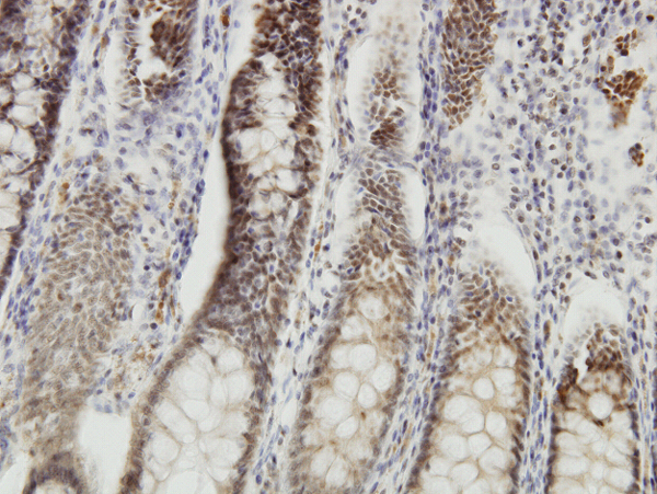 Immunoperoxidase of monoclonal antibody to DMTF1 on formalin-fixed paraffin-embedded human colon. [antibody concentration 1 ug/ml]