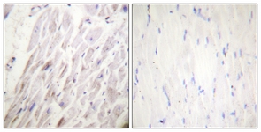 IHC of paraffin-embedded human heart, using Dematin (Phospho-Ser403) Antibody. The sample on the right was incubated with synthetic peptide.