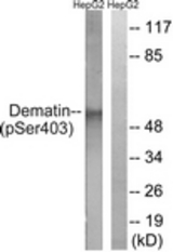 Western blot of extracts from HepG2 cells treated with Insulin 0.01U/ml 15', using Dematin (Phospho-Ser403) Antibody. The lane on the right was incubated with synthetic peptide.