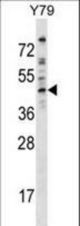 EPB49 Antibody western blot of Y79 cell line lysates (35 ug/lane). The EPB49 antibody detected the EPB49 protein (arrow).
