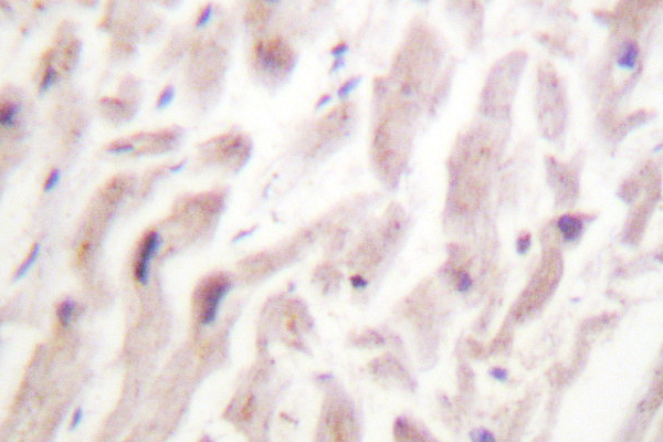 IHC of Dematin (E397) pAb in paraffin-embedded human heart tissue.