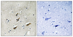 IHC of paraffin-embedded human brain tissue, using Dematin (Ab-403) Antibody. The picture on the right is treated with the synthesized peptide.