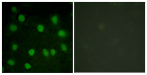 Immunofluorescence of HUVEC cells, using Dematin (Ab-403) Antibody. The picture on the right is treated with the synthesized peptide.
