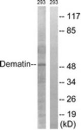 Western blot of extracts from 293 cells, using Dematin (Ab-403) Antibody. The lane on the right is treated with the synthesized peptide.