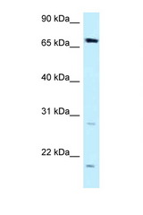 DMWD antibody LS-C145958 Western blot of MCF7 Cell lysate. Antibody concentration 1 ug/ml.