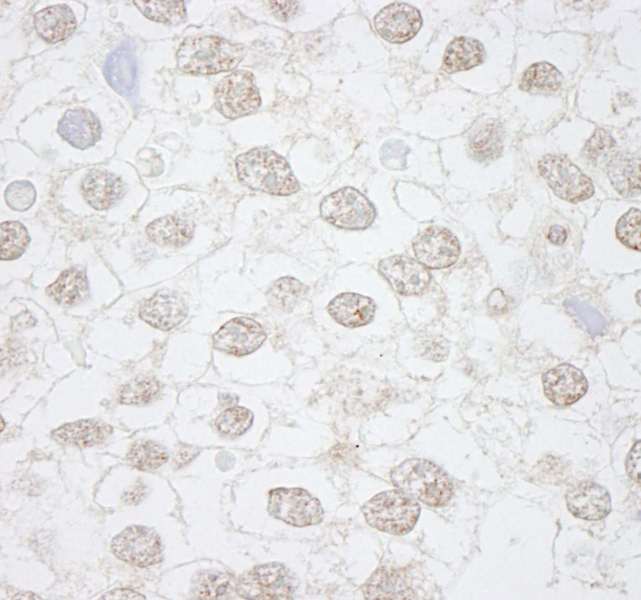 Detection of Human DMWD by Immunohistochemistry. Sample: FFPE section of human seminoma. Antibody: Affinity purified rabbit anti-DMWD used at a dilution of 1:250.