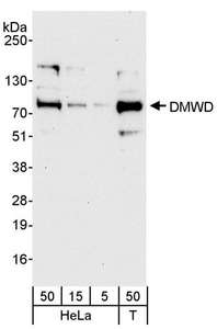 Detection of Human DMWD by Western Blot. Samples: Whole cell lysate from HeLa (5, 15 and 50 ug) and 293T (T; 50 ug) cells. Antibody: Affinity purified rabbit anti-DMWD antibody used for WB at 0.4 ug/ml. Detection: Chemiluminescence with an exposure time of 30 seconds.