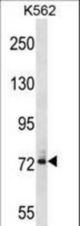 DNAI1 Antibody western blot of K562 cell line lysates (35 ug/lane). The DNAI1 antibody detected the DNAI1 protein (arrow).