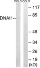 Western blot of extracts from COLO cells, using DNAI1 Antibody. The lane on the right was incubated with synthetic peptide.
