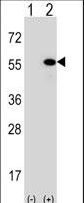 Western blot of DNAJA1 (arrow) using rabbit polyclonal DNAJA1 Antibody. 293 cell lysates (2 ug/lane) either nontransfected (Lane 1) or transiently transfected (Lane 2) with the DNAJA1 gene.