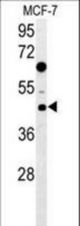 DNAJA1 Antibody western blot of MCF-7 cell line lysates (35 ug/lane). The DNAJA1 antibody detected the DNAJA1 protein (arrow).