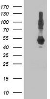 HEK293T cells were transfected with the pCMV6-ENTRY control (Left lane) or pCMV6-ENTRY DNAJA2 (Right lane) cDNA for 48 hrs and lysed. Equivalent amounts of cell lysates (5 ug per lane) were separated by SDS-PAGE and immunoblotted with anti-DNAJA2.