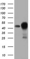 HEK293T cells were transfected with the pCMV6-ENTRY control (Left lane) or pCMV6-ENTRY DNAJA2 (Right lane) cDNA for 48 hrs and lysed. Equivalent amounts of cell lysates (5 ug per lane) were separated by SDS-PAGE and immunoblotted with anti-DNAJA2.