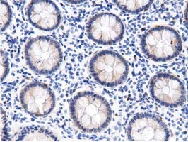 IHC of paraffin-embedded Human colon tissue using anti-DNAJA2 mouse monoclonal antibody. (Dilution 1:50).