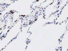 IHC of paraffin-embedded Human lung tissue using anti-DNAJA2 mouse monoclonal antibody. (Dilution 1:50).