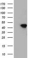 HEK293T cells were transfected with the pCMV6-ENTRY control (Left lane) or pCMV6-ENTRY DNAJA2 (Right lane) cDNA for 48 hrs and lysed. Equivalent amounts of cell lysates (5 ug per lane) were separated by SDS-PAGE and immunoblotted with anti-DNAJA2.