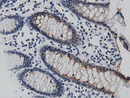 IHC of paraffin-embedded Human colon tissue using anti-DNAJA2 mouse monoclonal antibody. (Dilution 1:50).