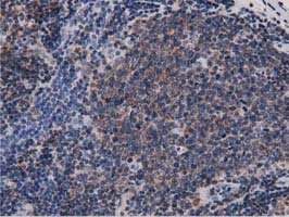 IHC of paraffin-embedded Human lymph node tissue using anti-DNAJA2 mouse monoclonal antibody. (Dilution 1:50).