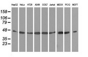Western blot of extracts (35 ug) from 9 different cell lines by using anti-DNAJA2 monoclonal antibody.