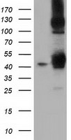 HEK293T cells were transfected with the pCMV6-ENTRY control (Left lane) or pCMV6-ENTRY DNAJA2 (Right lane) cDNA for 48 hrs and lysed. Equivalent amounts of cell lysates (5 ug per lane) were separated by SDS-PAGE and immunoblotted with anti-DNAJA2.