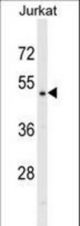 DNAJA2 Antibody western blot of Jurkat cell line lysates (35 ug/lane). The DNAJA2 antibody detected the DNAJA2 protein (arrow).