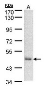 Sample (30 ug of whole cell lysate). A: A431 . 7.5% SDS PAGE. DNAJA2 antibody diluted at 1:500