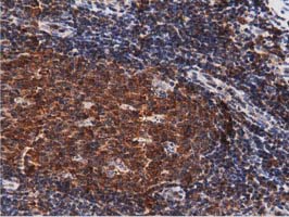 IHC of paraffin-embedded Human lymph node tissue using anti-DNAJA2 mouse monoclonal antibody. (Dilution 1:50).
