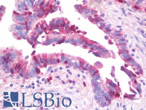 Anti-CLEC3B / Tetranectin antibody IHC staining of human lung. Immunohistochemistry of formalin-fixed, paraffin-embedded tissue after heat-induced antigen retrieval.