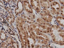 IHC of paraffin-embedded Human Kidney tissue using anti-DNAJA2 mouse monoclonal antibody. (Dilution 1:50).