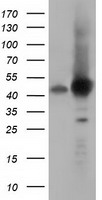 HEK293T cells were transfected with the pCMV6-ENTRY control (Left lane) or pCMV6-ENTRY DNAJA2 (Right lane) cDNA for 48 hrs and lysed. Equivalent amounts of cell lysates (5 ug per lane) were separated by SDS-PAGE and immunoblotted with anti-DNAJA2.