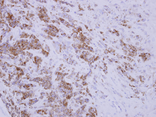 IHC of paraffin-embedded BT483 xenograft, using TID1 antibody at 1:250 dilution.