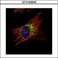 Confocal immunofluorescence analysis (Olympus FV10i) of methanol-fixed HeLa, using TID1 antibody (Green) at 1:500 dilution. Alpha-tubulin filaments were labeled with alpha-tubulin antibody (Red) at 1:2000.