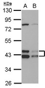 Sample (30 ug of whole cell lysate) A: HepG2 B: HCT116 10% SDS PAGE DNAJA3 / TID1 antibody diluted at 1:1000