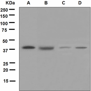 Western blot analysis on (A) Jurkat, (B) HepG2, (C) HeLa and (D) 293T cell lysates using anti-HSP40 antibody.