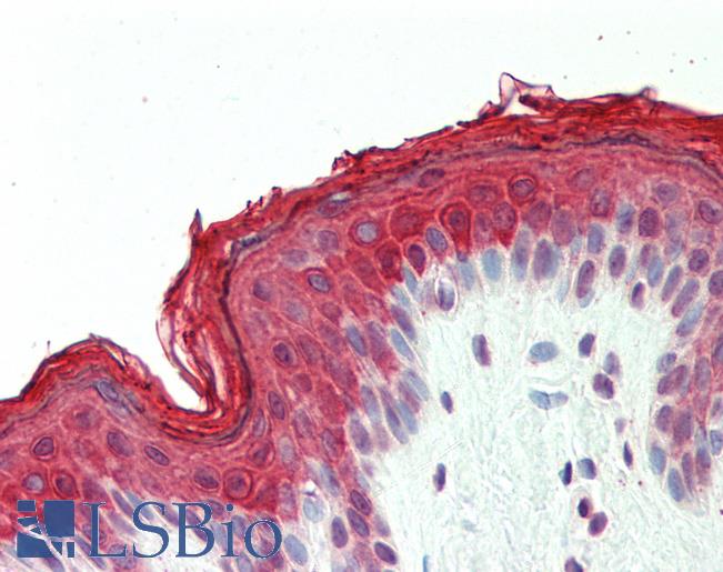 Human, Skin: Formalin-Fixed Paraffin-Embedded (FFPE)