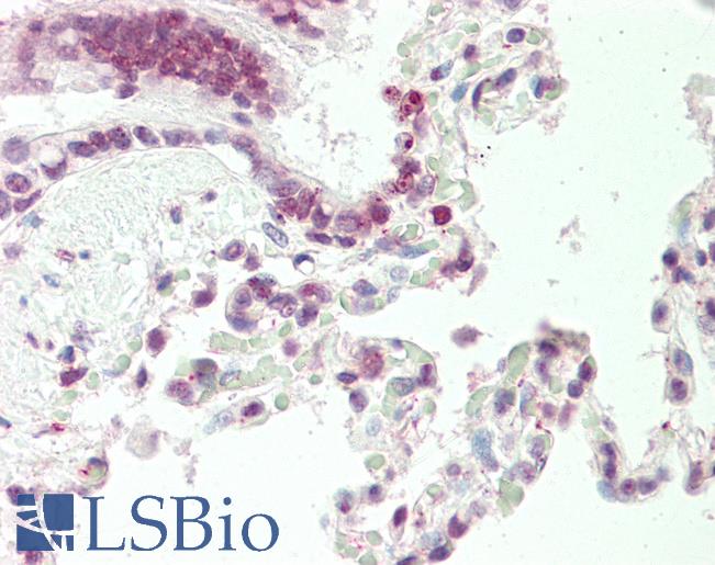 Human, Lung: Formalin-Fixed Paraffin-Embedded (FFPE)